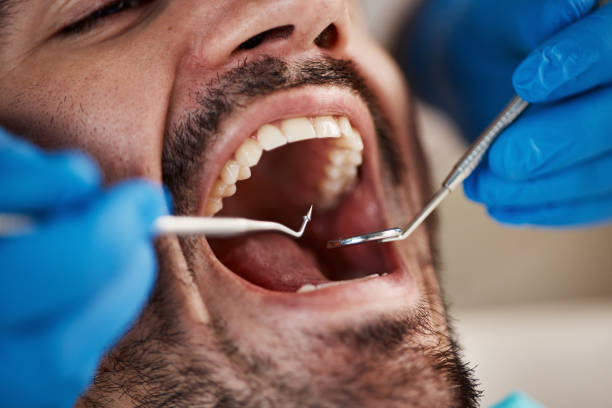 Best Emergency Dentist for Knocked-Out Tooth in Brazoria, TX